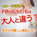 子供のむち打ちには大人と違う？