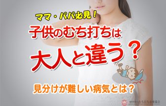 子供のむち打ちには大人と違う？