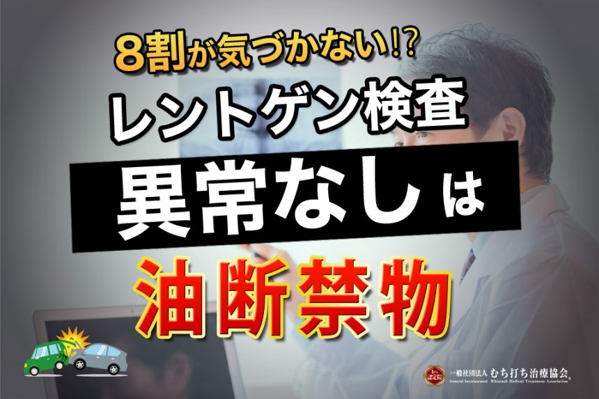 8割が気づかない⁉レントゲン検査異常なしは油断禁物